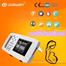 DW-600 portable ultrasound machine price & sheep pregnancy ultrasound scanner